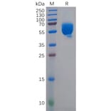 SDS-PAGE - Recombinant Human CD83 Protein (Fc Tag) (A318145) - Antibodies.com
