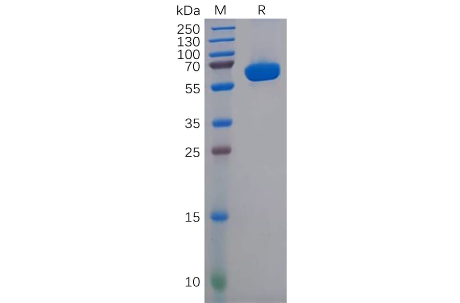 SDS-PAGE - Recombinant Human CD2 Protein (Fc Tag) (A318146) - Antibodies.com