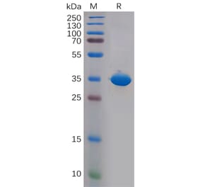 SDS-PAGE - Recombinant Human CD81 Protein (Fc Tag) (A318147) - Antibodies.com
