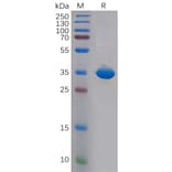 SDS-PAGE - Recombinant Human CD81 Protein (Fc Tag) (A318147) - Antibodies.com