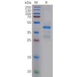 SDS-PAGE - Recombinant Human PTN Protein (Fc Tag) (A318148) - Antibodies.com