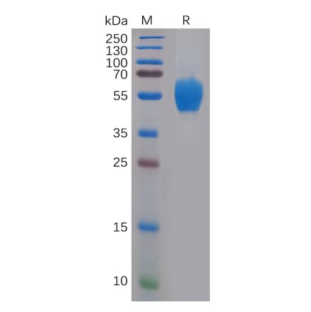 SDS-PAGE - Recombinant Human FGFR4 Protein (6×His Tag) (A318149) - Antibodies.com