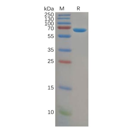 SDS-PAGE - Recombinant Human Albumin Protein (6×His Tag) (A318150) - Antibodies.com
