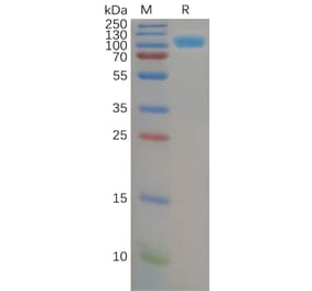 SDS-PAGE - Recombinant Human DPP4 Protein (6×His Tag) (A318151) - Antibodies.com