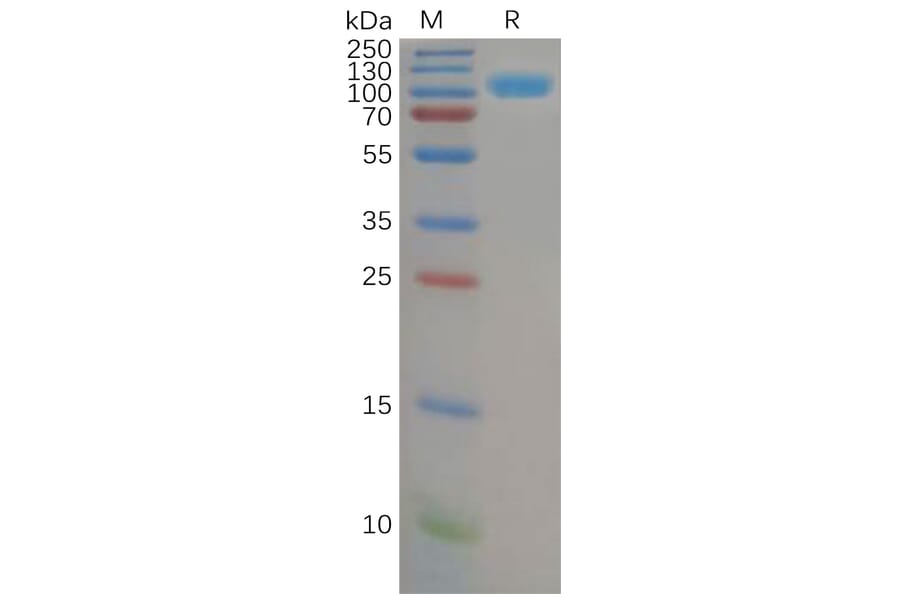 SDS-PAGE - Recombinant Human DPP4 Protein (6×His Tag) (A318151) - Antibodies.com