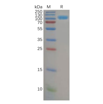 SDS-PAGE - Recombinant Human DPP4 Protein (6×His Tag) (A318151) - Antibodies.com