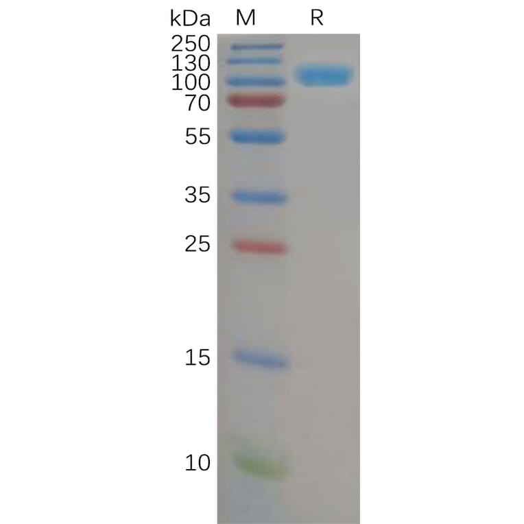 SDS-PAGE - Recombinant Human DPP4 Protein (6×His Tag) (A318151) - Antibodies.com