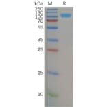 SDS-PAGE - Recombinant Human DPP4 Protein (6×His Tag) (A318151) - Antibodies.com