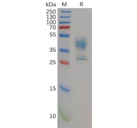 SDS-PAGE - Recombinant Human P Glycoprotein Protein (Fc Tag) (A318152) - Antibodies.com