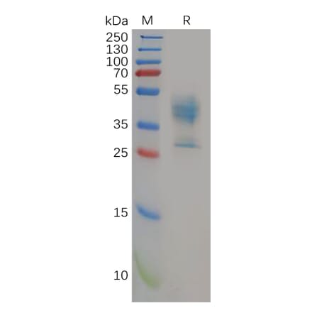 SDS-PAGE - Recombinant Human P Glycoprotein Protein (Fc Tag) (A318152) - Antibodies.com