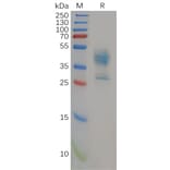 SDS-PAGE - Recombinant Human P Glycoprotein Protein (Fc Tag) (A318152) - Antibodies.com
