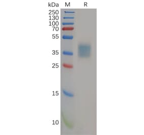 SDS-PAGE - Recombinant Human IL-21R Protein (6×His Tag) (A318154) - Antibodies.com