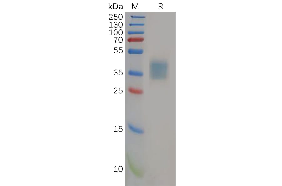 SDS-PAGE - Recombinant Human IL-21R Protein (6×His Tag) (A318154) - Antibodies.com