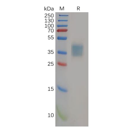 SDS-PAGE - Recombinant Human IL-21R Protein (6×His Tag) (A318154) - Antibodies.com