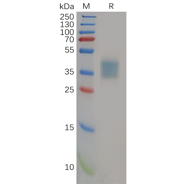 SDS-PAGE - Recombinant Human IL-21R Protein (6×His Tag) (A318154) - Antibodies.com