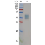 SDS-PAGE - Recombinant Human IL-21R Protein (6×His Tag) (A318154) - Antibodies.com