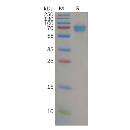 SDS-PAGE - Recombinant Human IL-21R Protein (Fc Tag) (A318155) - Antibodies.com