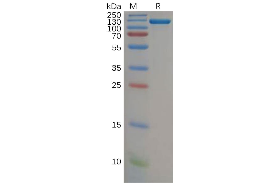 SDS-PAGE - Recombinant Human Complement Factor B Protein (Fc Tag) (A318156) - Antibodies.com