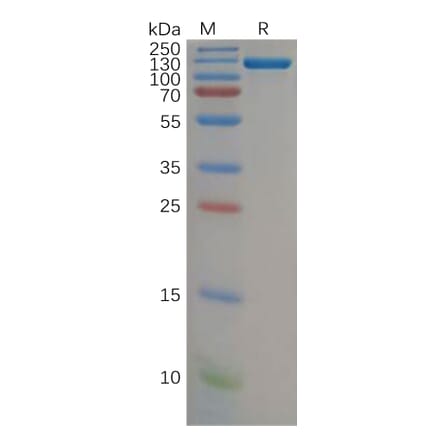 SDS-PAGE - Recombinant Human Complement Factor B Protein (Fc Tag) (A318156) - Antibodies.com