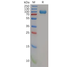SDS-PAGE - Recombinant Human DPP4 Protein (6×His Tag) (A318157) - Antibodies.com