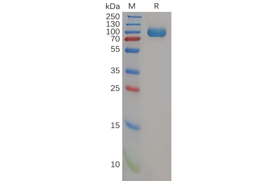 SDS-PAGE - Recombinant Human DPP4 Protein (6×His Tag) (A318157) - Antibodies.com