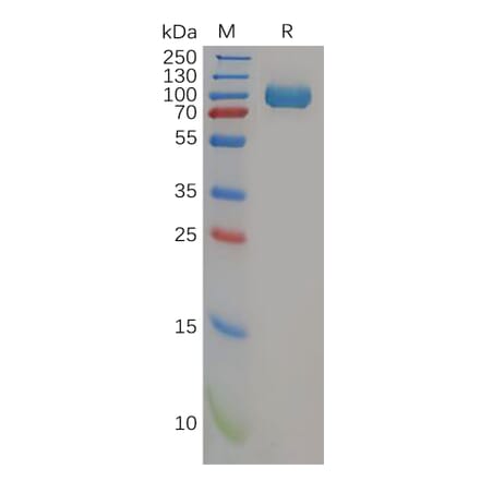 SDS-PAGE - Recombinant Human DPP4 Protein (6×His Tag) (A318157) - Antibodies.com
