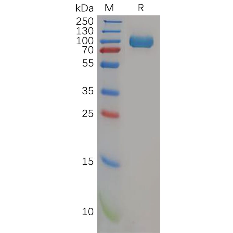 SDS-PAGE - Recombinant Human DPP4 Protein (6×His Tag) (A318157) - Antibodies.com