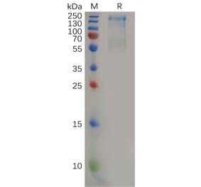 SDS-PAGE - Recombinant Human CD45 Protein (6×His Tag) (A318158) - Antibodies.com