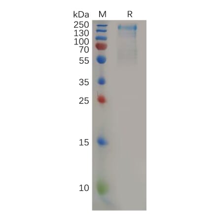 SDS-PAGE - Recombinant Human CD45 Protein (6×His Tag) (A318158) - Antibodies.com