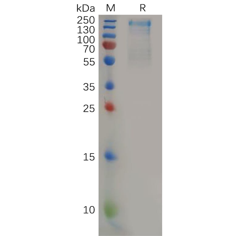 SDS-PAGE - Recombinant Human CD45 Protein (6×His Tag) (A318158) - Antibodies.com