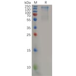 SDS-PAGE - Recombinant Human CD45 Protein (6×His Tag) (A318158) - Antibodies.com