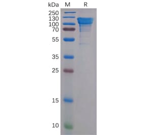 SDS-PAGE - Recombinant Human Amyloid Precursor Protein Protein (6×His Tag) (A318159) - Antibodies.com