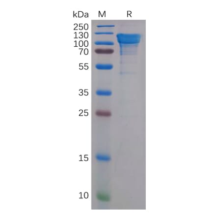 SDS-PAGE - Recombinant Human Amyloid Precursor Protein Protein (6×His Tag) (A318159) - Antibodies.com