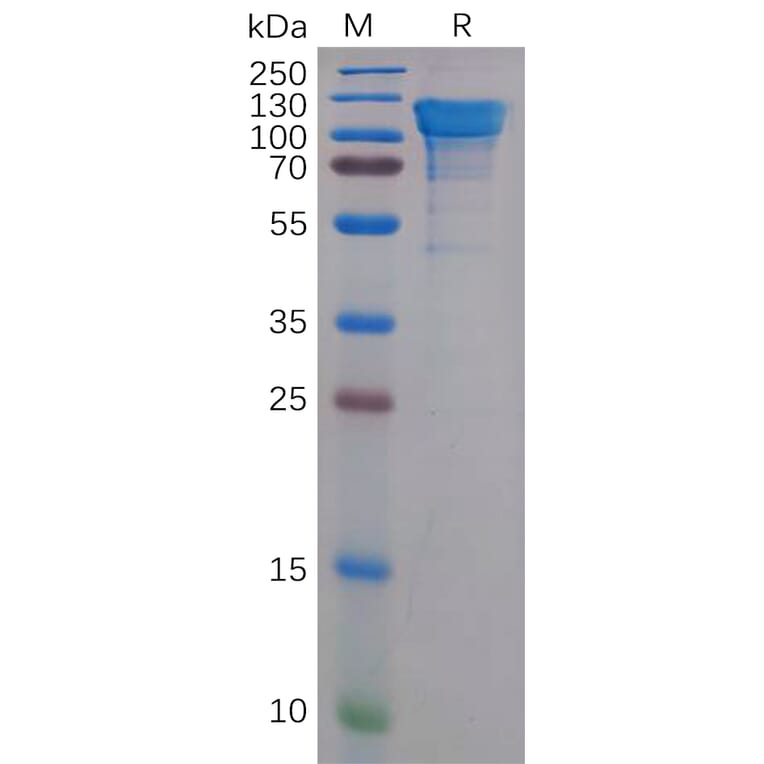 SDS-PAGE - Recombinant Human Amyloid Precursor Protein Protein (6×His Tag) (A318159) - Antibodies.com