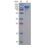 SDS-PAGE - Recombinant Human Amyloid Precursor Protein Protein (6×His Tag) (A318159) - Antibodies.com