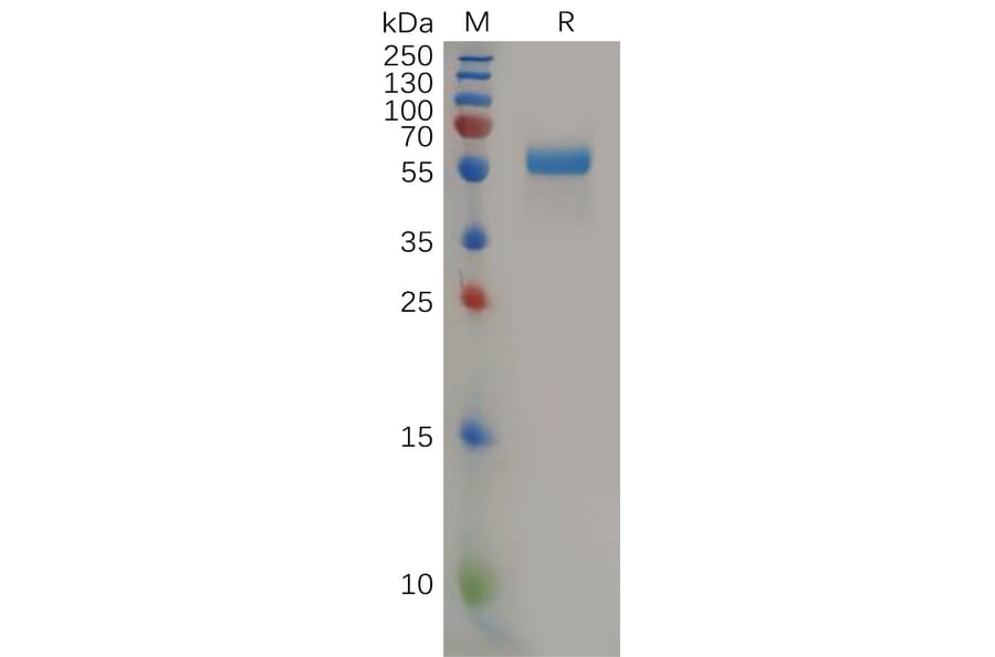 SDS-PAGE - Recombinant Human PLGF Protein (Fc Tag) (A318160) - Antibodies.com