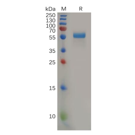 SDS-PAGE - Recombinant Human PLGF Protein (Fc Tag) (A318160) - Antibodies.com