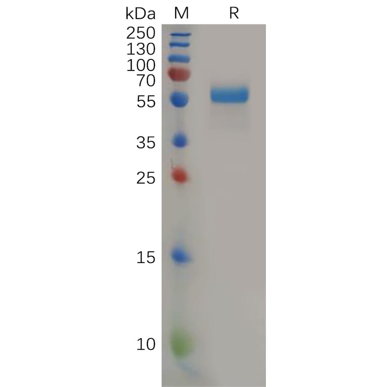 SDS-PAGE - Recombinant Human PLGF Protein (Fc Tag) (A318160) - Antibodies.com