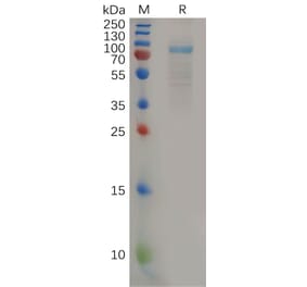 SDS-PAGE - Recombinant Human IL-11RA Protein (Fc Tag) (A318161) - Antibodies.com