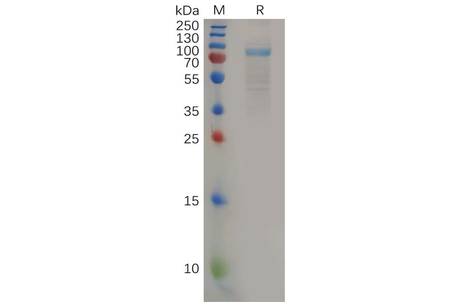 SDS-PAGE - Recombinant Human IL-11RA Protein (Fc Tag) (A318161) - Antibodies.com