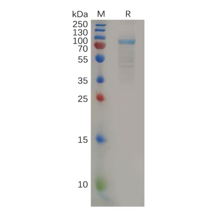 SDS-PAGE - Recombinant Human IL-11RA Protein (Fc Tag) (A318161) - Antibodies.com