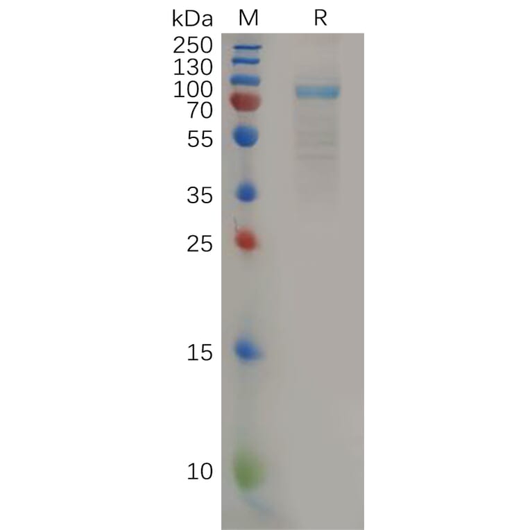 SDS-PAGE - Recombinant Human IL-11RA Protein (Fc Tag) (A318161) - Antibodies.com