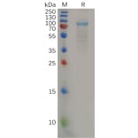 SDS-PAGE - Recombinant Human IL-11RA Protein (Fc Tag) (A318161) - Antibodies.com