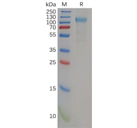 SDS-PAGE - Recombinant Human TLR3 Protein (6×His Tag) (A318162) - Antibodies.com