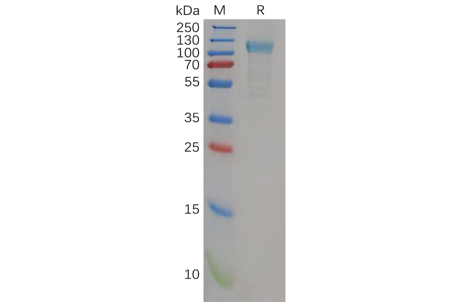 SDS-PAGE - Recombinant Human TLR3 Protein (6×His Tag) (A318162) - Antibodies.com