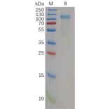 SDS-PAGE - Recombinant Human TLR3 Protein (6×His Tag) (A318162) - Antibodies.com