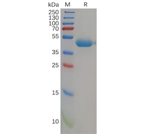 SDS-PAGE - Recombinant Human Nectin 2 Protein (6×His Tag) (A318163) - Antibodies.com