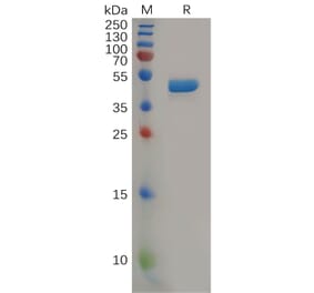 SDS-PAGE - Recombinant Human IL-2 Protein (Fc Tag) (A318165) - Antibodies.com