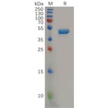 SDS-PAGE - Recombinant Human IL-2 Protein (Fc Tag) (A318165) - Antibodies.com