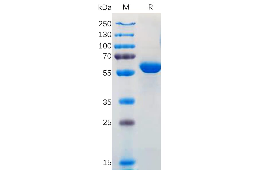 SDS-PAGE - Recombinant SARS-CoV-2 Spike Glycoprotein RBD (Kappa B.1.617/B.1.617.1/B.1.617.3 Variant) (Fc Tag) (A318168) - Antibodies.com